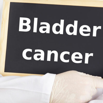 Bladder Cancer and its Symptoms