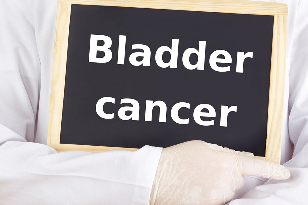 Bladder Cancer and its Symptoms