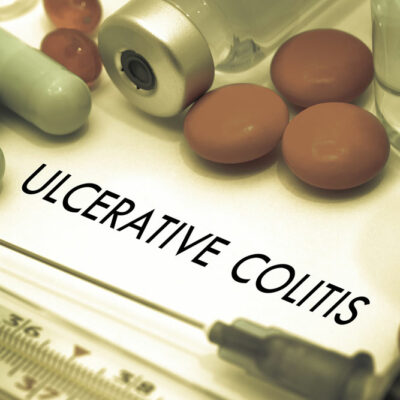 Causes and Complications for Patients with Ulcerative Colitis