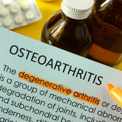 Effective Types of Treatment for Osteoarthritis