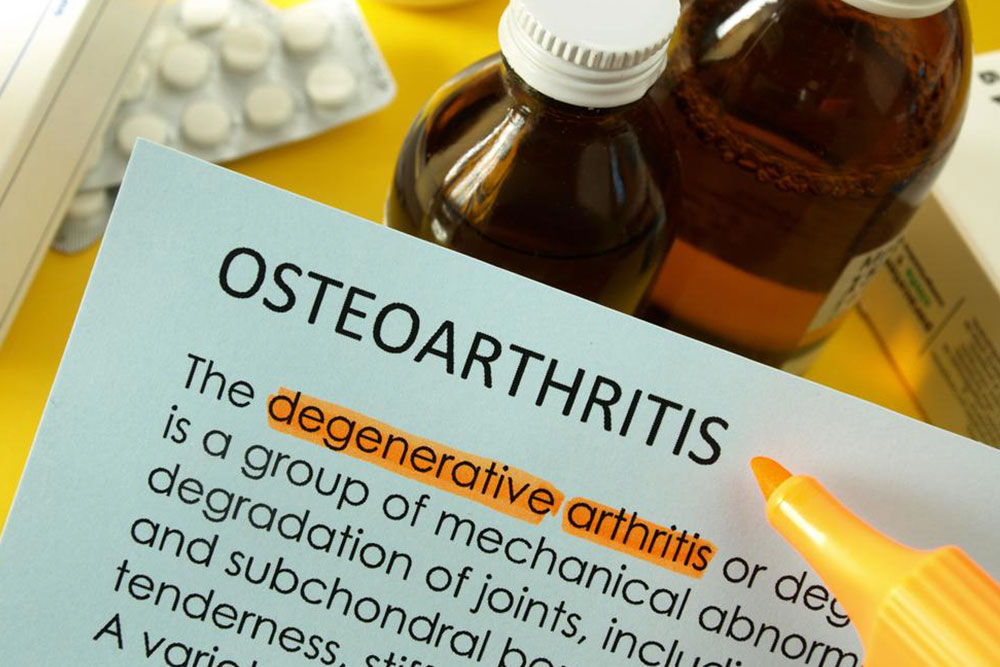 Effective Types of Treatment for Osteoarthritis