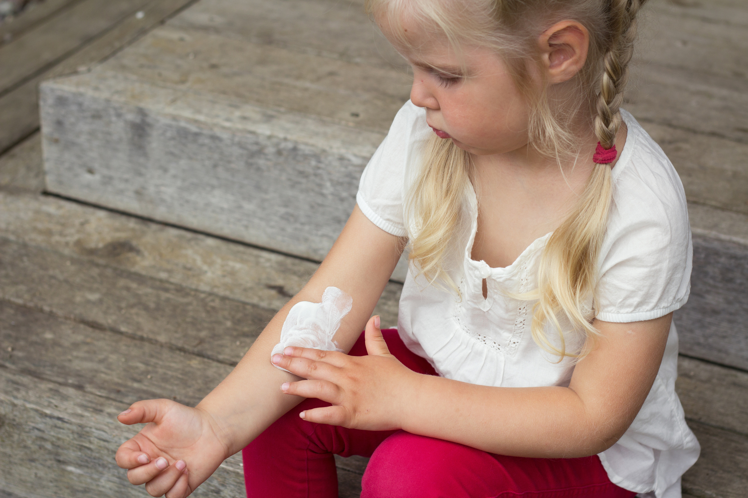 Natural Treatments to Treat Atopic Dermatitis in Kids