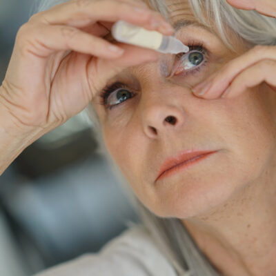 Remedies to Cure Dry Eyes Without Medication