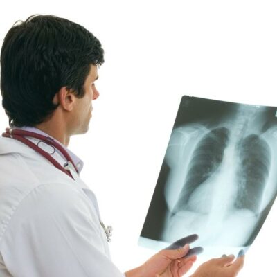 The Causes of Non-Small Cell Lung Cancer
