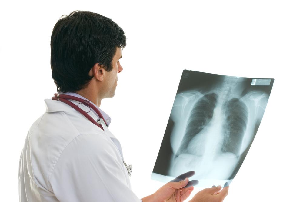 The Causes of Non-Small Cell Lung Cancer