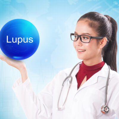 The Signs and Symptoms of Lupus