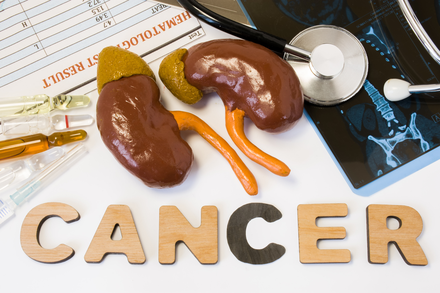 What to Know About Kidney Cancer